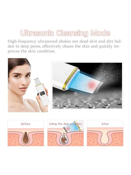 Urządzenie do peelingu ultradźwiękowego 4in1 - 6