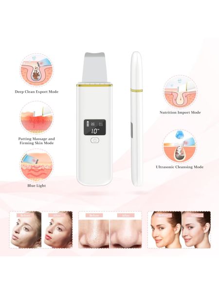 Urządzenie do peelingu ultradźwiękowego 4in1 - 3